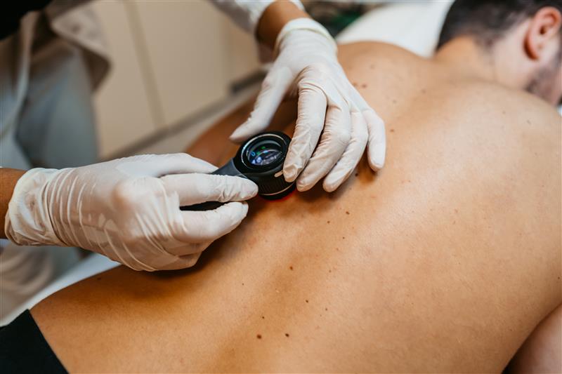Skin Cancer Screenings